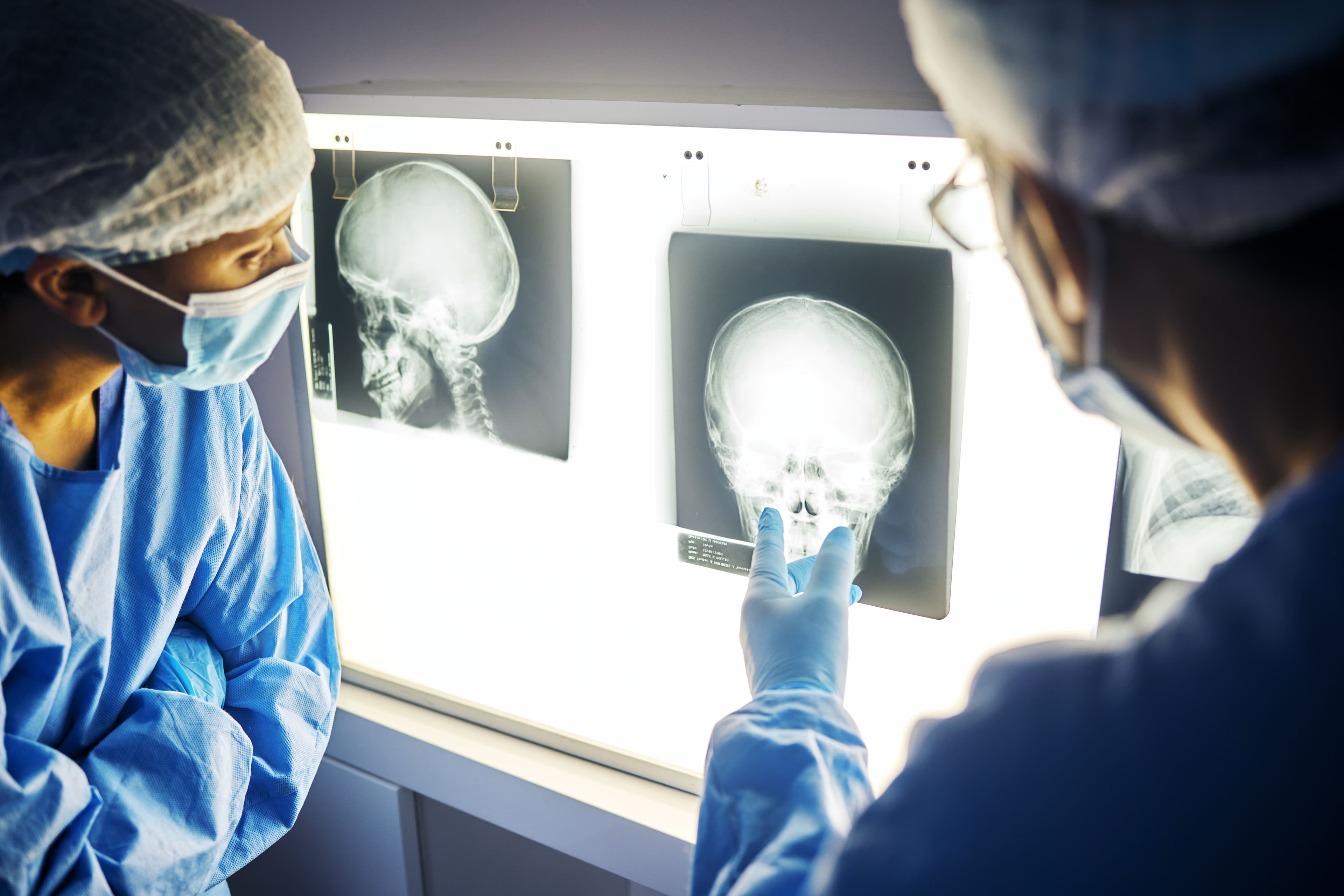 5 Mistakes That Can Hurt Your Traumatic Brain Injury Case
