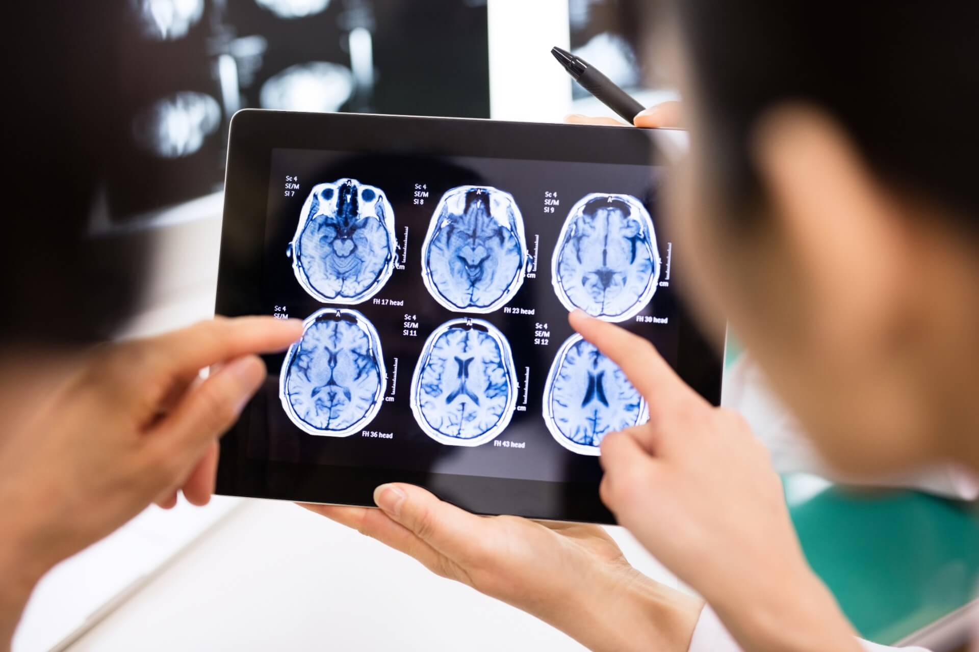 doctors looking at head injury brain scans